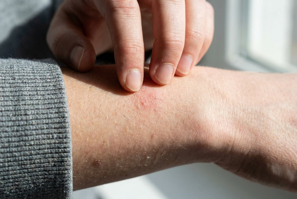 What Is a Textile Allergy?